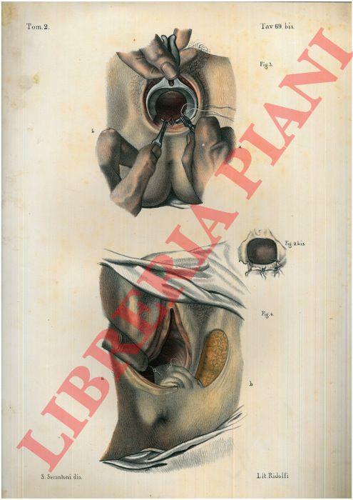 Perineorafia e perineoplastica - copertina