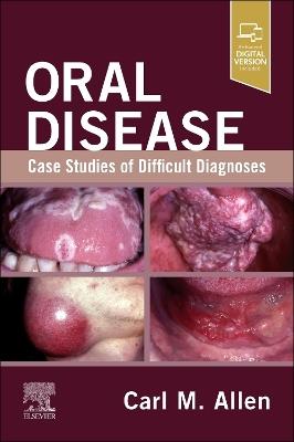 Oral Disease: Case Studies of Difficult Diagnoses: Case Studies of Difficult Diagnoses - Carl M. Allen - cover