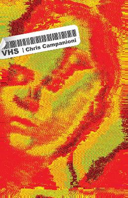 ibs