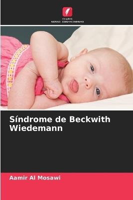 Síndrome de Beckwith Wiedemann - Aamir Al Mosawi - cover