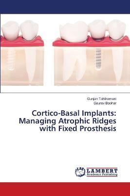 Cortico-Basal Implants: Managing Atrophic Ridges with Fixed Prosthesis - Gunjan Tahilramani,Gaurav Beohar - cover