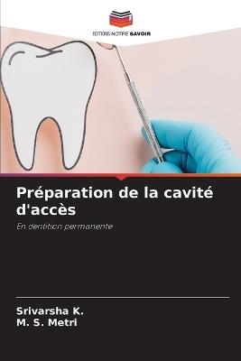 Préparation de la cavité d'accès - Srivarsha K,M S Metri - cover