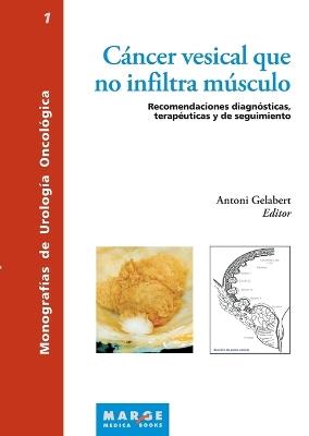 Cáncer vesical que no infiltra músculo - Antoni Gilabert Mas - cover