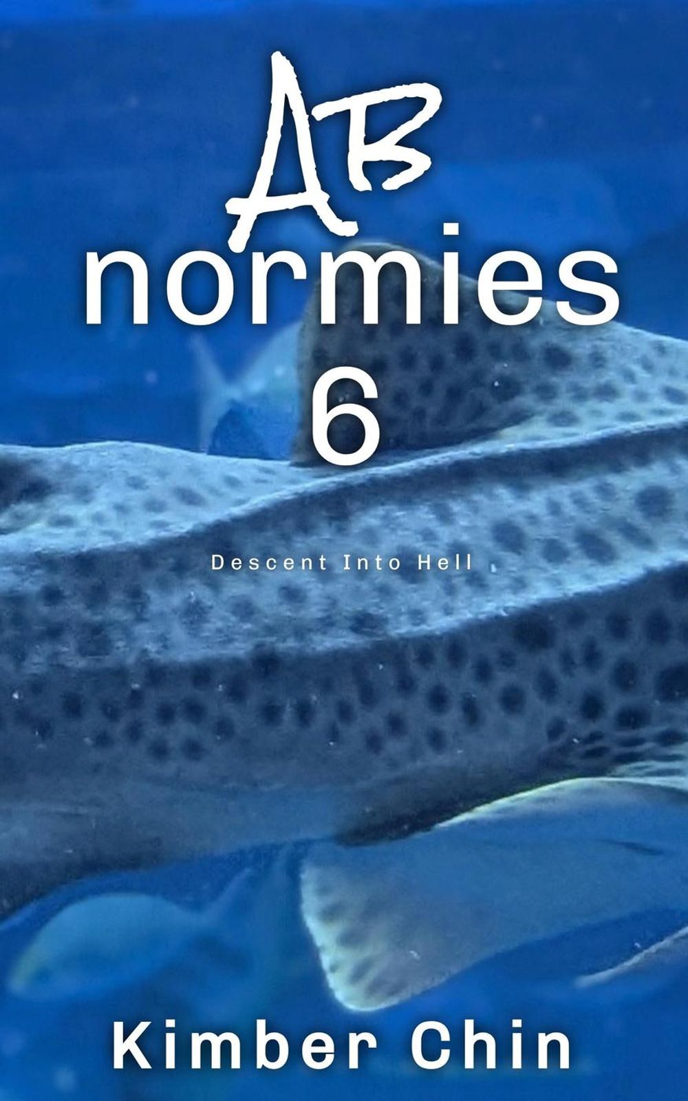 ibs